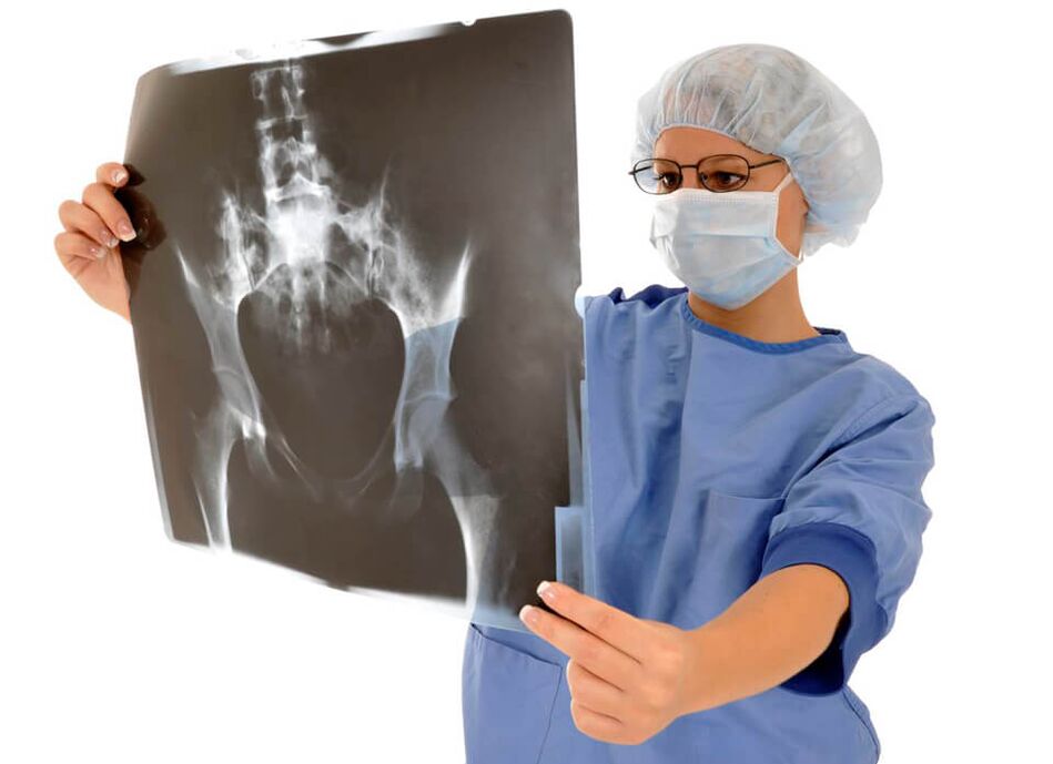 Ang X-ray sa hip joint makatabang sa doktor sa pagtino sa hinungdan sa kasakit
