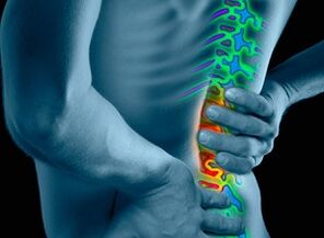 Mga Hinungdan ug Sintomas sa Osteochondrosis