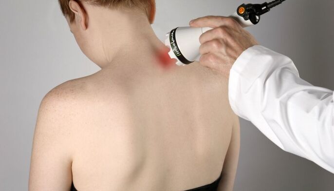 laser therapy alang sa cervical osteochondrosis